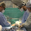 Telegraf ekskluzivno u operacionoj sali KCS: Ovako su lekari ugradili 100. bajpas na kucajućem srcu