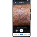 Google Lens vam sada omogućava da potražite informacije o stanju kože