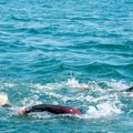 Žena je bezbrižno plivala u jezeru, a onda je osetila kako joj zubi i kandže kidaju meso! Unakaženo joj i lice i telo, nije…