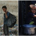 Horor rata u Gazi Čak 21.000 palestinske dece postala invalidi
