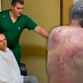 (Uznemirujuće fotografije) "U šok sobi je, teško povređen!" Najnoviji detalji o stanju Srbina kog je mučki pretukla tzv…