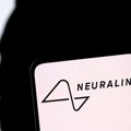 Neuralink ugradio implantat u čovjekov mozak