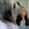 Kako nekima kosa posedi već u tinejdžerskom dobu