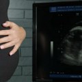 Putokaz za mame i tate: Epiduralna anestezija