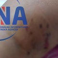 Drama u Prijepolju: Pas lutalica napao sedmogodišnju devojčicu dok se igrala u svom dvorištu, izujedao je za nogu, ruku…