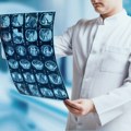 Jednostavan test iz krvi mogao bi spasiti živote obolelih od tumora mozga
