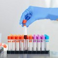 Institut za transfuziju krvi pozvao građane da daju krv: Akcije sledeće nedelje širom Beograda - evo na kojim lokacijama