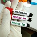 SZO: Virus hepatitisa dnevno ubije 3.500 ljudi