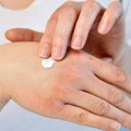 OPREZ! Ova krema može izazvati infekciju: RAPEX upozorava na mikrobiološku opasnost