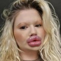 (Foto) ima najveće usne na svetu, ali joj ni to nije dovoljno: Bugarka dala milione hirurgu koji ne želi da je operiše, ali…
