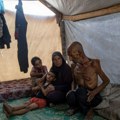 UN: još tri Palestinca u Pojasu Gaze umrla od gladi za poslednja 24 sata