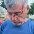 Kancelarija za KiM: Srbin na Kosovu pretučen dok je pokušao da odbrani sina od napadača