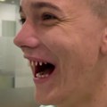 Jutjuber šokirao objavom: Pokazala izbrušene zube, svoje prirodne zamenio veštačkim, evo kako sada izgleda