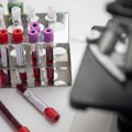 SZO: Rizik od epidemije kuge u Rusiji je nizak