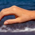 Crvenilo, osip i svrab na plaži: Prve znake alergije na sunce možete da sprečite na vreme