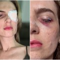 Popila sam lek za menstrualne bolove koji svi imaju u kući i ostala slepa: 17 dana sam bila u komi, lekari su rekli da je čudo…