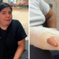 Identifikovani maloletnici koji su brutalno pretukli vršnjaka u Nišu: Posledice, amputacija, i strahovi su trajni