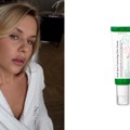 Borite se sa hiperpigmentacijom? Vreme je da uvedete ovaj viralni serum u „beauty“ rotaciju