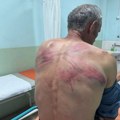 Srpska lista: Pripadnici kosovske policije pretukli Nenada Raškovića kod Zubinog Potoka