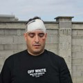 Snimili smo Darka Lazića u brestaču: Nakon jezive nesreće sa zavojima na glavi poručuje: "Nisam video autobus, i dalje ću…