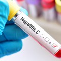 Хепатитис Ц је тешка болест која се лечи ако се открије на време