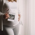 Važan korak za uspešniju vantelesnu oplodnju u „Narodnom frontu“– nova genetička analiza embriona