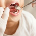 700.000 Ljudi u Srbiji nema nijedan zub Srbiji treba državna stomatologija, evo kako bi to moglo da se reši