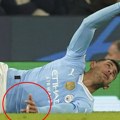 Fudbaler Sitija slomio prst na meču Lige šampiona: Skroz se okrenuo na drugu stranu, vrištao od bolova