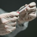 Ministarstvo poljoprivrede: Odneseni leševi životinja pronađeni u kontejneru u Mačvi