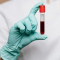 Британци раде на тесту крви који би могао да предвиди болести и до 10 година унапред