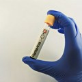 Buknuo smrtonosni virus na kruzeru, sumnja se na hantavirus