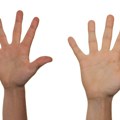Studija pokazala: Dužina prsta može da ukaže na psihološke poremećaje