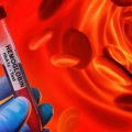 Sedam opasnih nivoa hemoglobina: Značenje kritičnih vrednosti i simptomi koji ih odaju