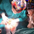 Nesvakidašnji poduhvat srpske hirurgije: U Kliničkom centru prvi put izvedena operacija raka pankreasa, koja se radi u samo…
