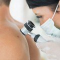 Udruženje: Oboleli od melanoma nemaju adekvatne terapije koje postoje u regionu