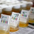 „Ko odbije – jasno je zašto“: Test na drogu u niškoj Skupštini