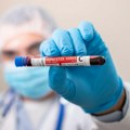 У Србији 80.000 инфицираних вирусом хепатитиса Ц: Масовно тестирање и опрез једини начин да се болест сведе не минимум