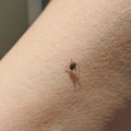 Мало људи зна за трик са телефоном који вам лако помаже да пронађете крпеље