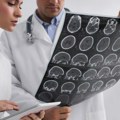 Neurolozi: Ovi simptomi mogu se javiti godinama pre dijagnoze multiple skleroze