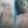 Živog ga jedu stenice, rane su po celom telu! Jeziv snimak iz paklenog zatvora kida dušu