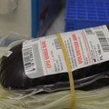 Smanjene rezerve krvi, koje krvne grupe su najpotrebnije?