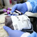 Apel Instituta: Alarmantan manjak krvi za transfuziju