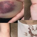 Studentkinja Poljoprivrednog dala iskaz u policiji u prisustvu advokata