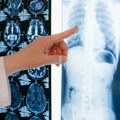 Ultrazvuk, rendgen, ct i magnetna rezonanca – Kada se primenjuju, šta otkrivaju i koja je najbezbednija metoda