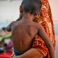 Epidemija malih boginja u Bangladešu:Desetine hiljada zaraženih i gotovo 1.000 mrtvih