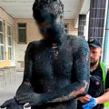 "Čovek-katran" zaprepastio policiju: Umazao se od glave do pete i izveo "pljačku veka", kupali ga 5 sati da bi mogli da ga…