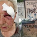 Сазнајемо! У Београду претучен генерал у пензији: Тројица га песничила на аутобуској станици, затворили му око! (узнемирујућ…