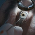 U nedostatku lekara i kataraktu će operisati roboti, zahvaljujući ovom startapu