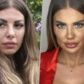 Dragana Mitar više ne izgleda ovako: Samo na licu imala više od 10 operacija, bivša modelsica otišla na korekciju brade, ne…