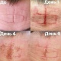 Uznemirujuće! Žive ih žigošu, urezuju simbole Rusije po telu! Jezivo svedočenje vojnika iz pakla zarobljeništva: Ovaj čovek…